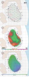 Pebble Beach StrackaLine