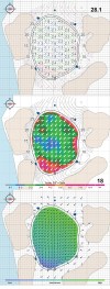 Pebble Beach StrackaLine